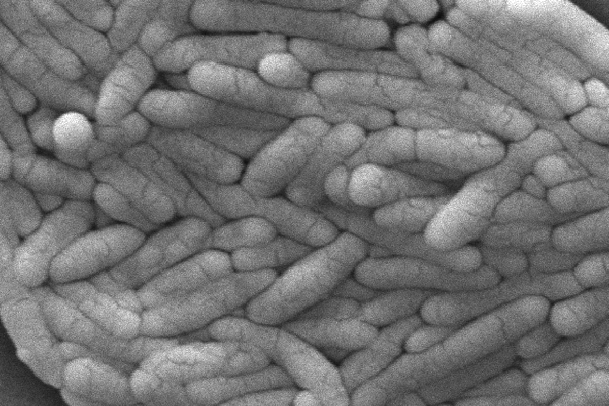 Salmonella linked to recalled mini pastries may have infected nearly 1,600 across Canada, public health agency says | Canada Voices